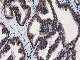 PRKCE / PKC-Epsilon Antibody (clone OTI1B7)