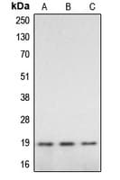 CASP2 / Caspase 2 Antibody (Internal)