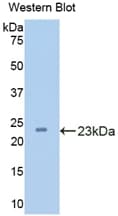 CPN1 Antibody (aa159-325, FITC)