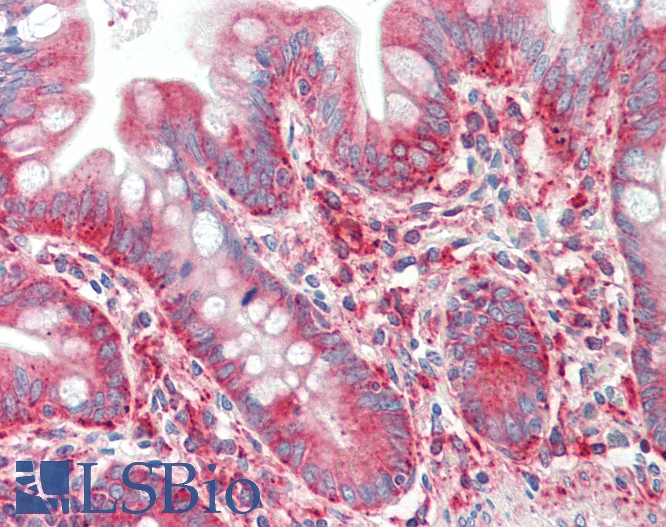 IHC-plus™ TNFSF12 / TWEAK Antibody (Pro73)