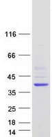 Human DHRS1 Protein (Recombinant Myc-DDK (Flag))
