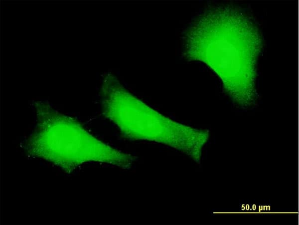 IHC-plus™ FANCC Antibody (clone 6E7)