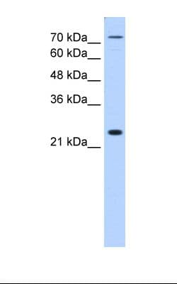 CLDN2 / Claudin 2 Antibody (aa51-100)