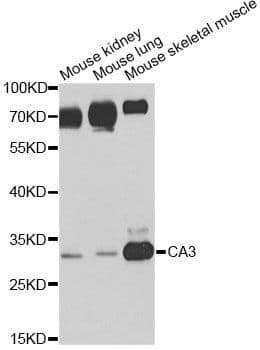 Polyclonal Rabbit anti-Human CA3 / Carbonic Anhydrase III Antibody (IF, WB)