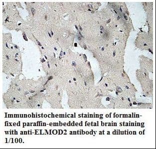 ELMOD2 Antibody (aa21-207)