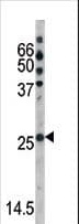 CDKN1B / p27 Kip1 Antibody (phospho-Ser178)