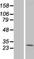 TMEM187 Protein (Over-Expression Lysate Myc-DDK (Flag))