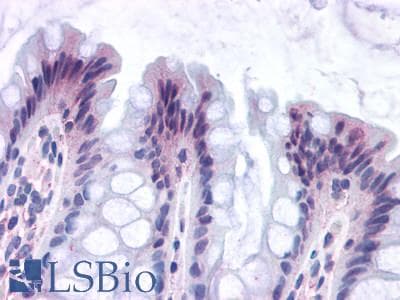 PathPlus™ GPR82 Antibody (Cytoplasmic Domain)