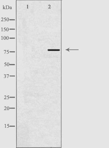 ACSL6 Antibody