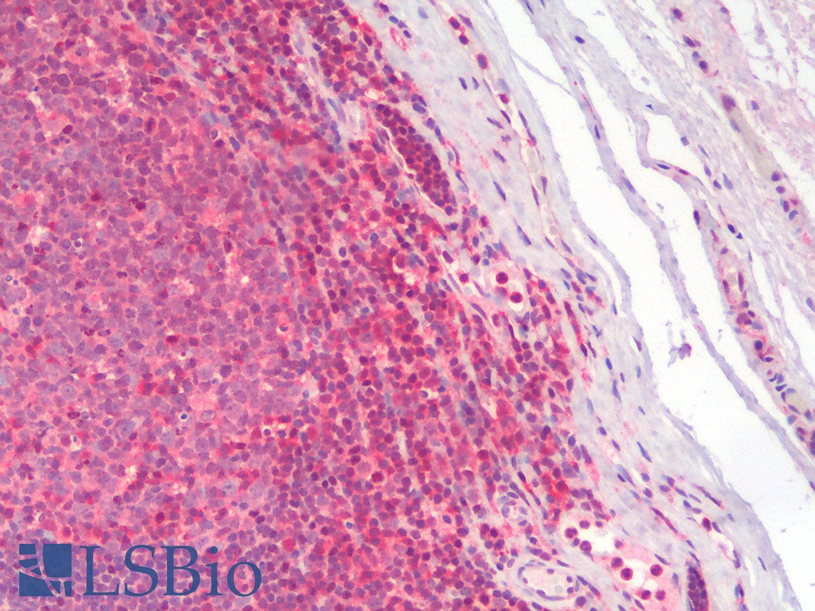 IHC-plus™ Polyclonal Rabbit anti-Human CD28 Antibody (IHC, IF, WB)