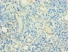 Polyclonal Rabbit anti-Human HOXB5 Antibody (aa1-170, IHC, WB)