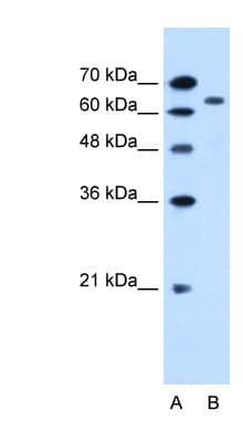 SLC22A3 / OCT3 Antibody (aa46-95)
