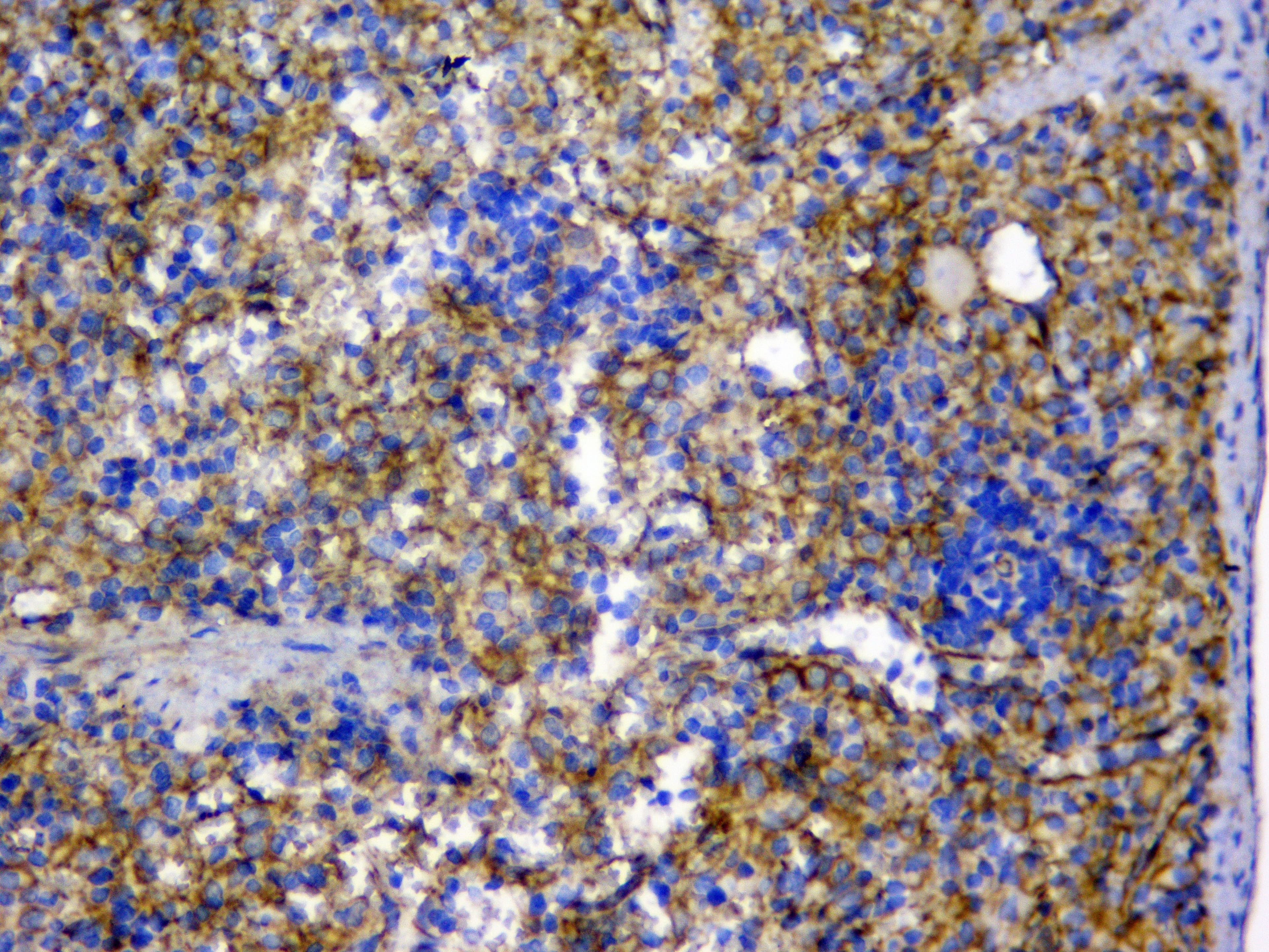 CTNNB1 / Beta Catenin Antibody