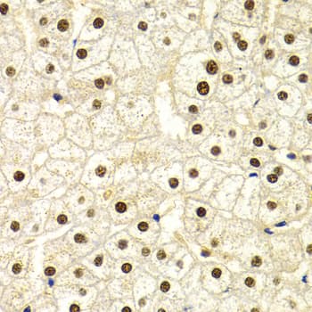 Polyclonal Rabbit anti-Human DDB1 Antibody (IHC, WB)