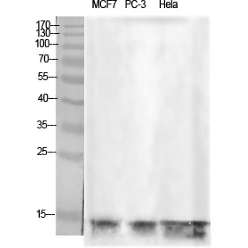 Histone H2B Antibody (10-90 aa)