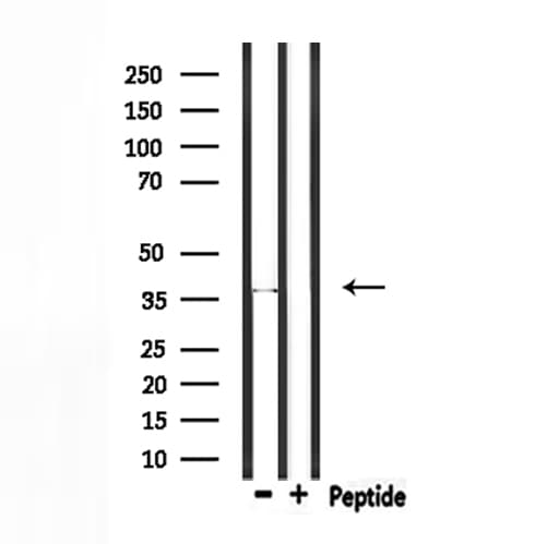 RNF41 Antibody
