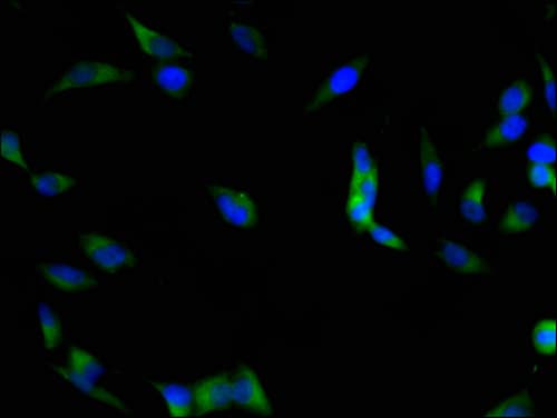 FAK / Focal Adhesion Kinase Antibody