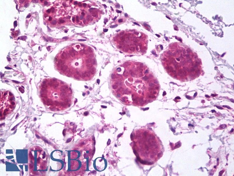 IHC-plus™ Polyclonal Rabbit anti-Human GPRC5A / RAI3 Antibody (N-Terminus, IHC, WB)