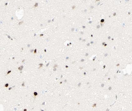 Polyclonal Rabbit anti-Human C/EBP Beta / CEBPB Antibody (phospho-Thr235,phospho-Thr188, IHC, IF, WB)