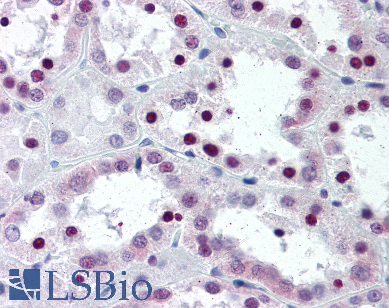 IHC-plus™ Monoclonal Mouse anti-Human SRSF1 / SF2 Antibody (N-Terminus, IHC, IF, WB)