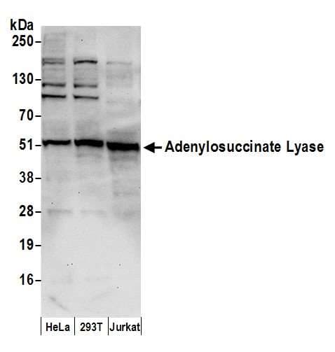 Polyclonal Rabbit anti-Human ADSL / Adenylosuccinate Lyase Antibody (aa200-250, WB)