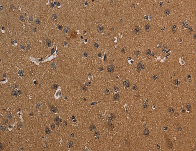 Polyclonal Rabbit anti-Human ICAM4 / CD242 Antibody (IHC)