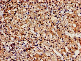 TBC1D4 / AS160 Antibody