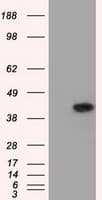ACAT2 Antibody (clone OTI3C9)