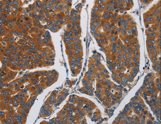 APH / APEH Antibody