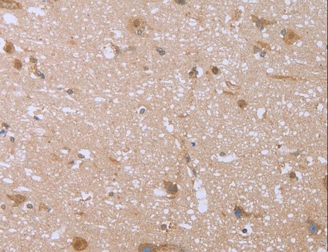 Polyclonal Rabbit anti-Human FHL2 Antibody (IHC, WB)