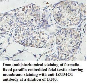 Polyclonal Rabbit anti-Human IZUMO1 / IZUMO Antibody (aa51-211, IHC, WB)
