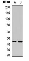 IHC-plus™ INHBB / Inhibin Beta B Antibody (Internal)