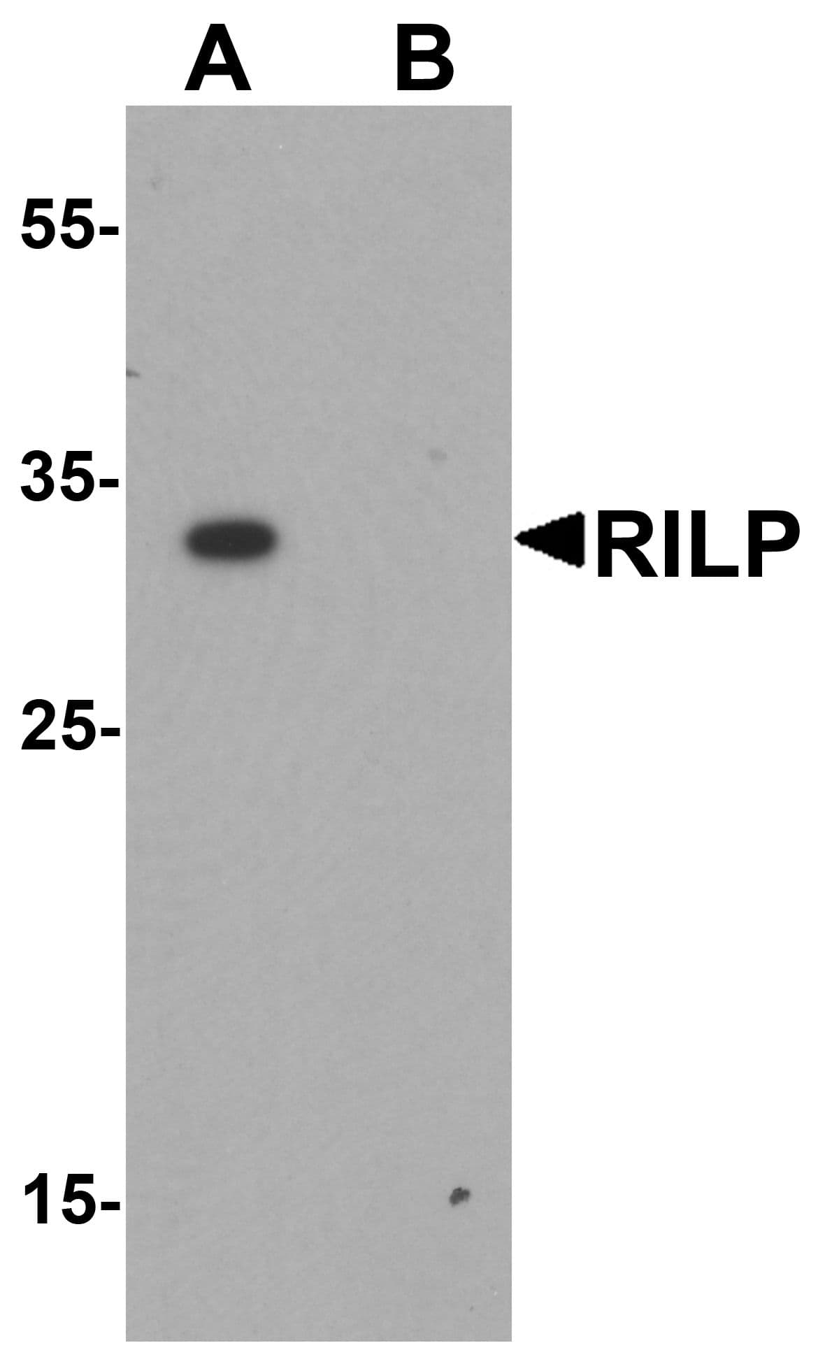 IHC-plus™ Polyclonal Rabbit anti-Human RILP Antibody (IHC, IF, WB)