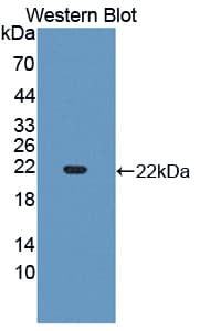 CYP3A4 / Cytochrome P450 3A4 Antibody (aa344-497)