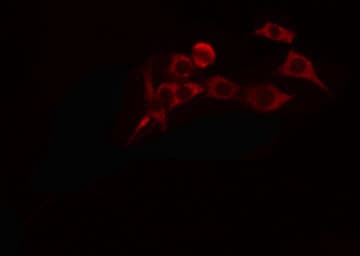 CYP4A11 Antibody