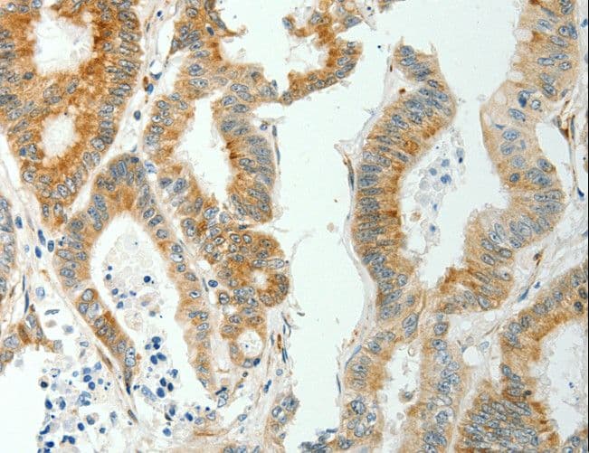 Polyclonal Rabbit anti-Human SELM / Selenoprotein M Antibody (IHC)