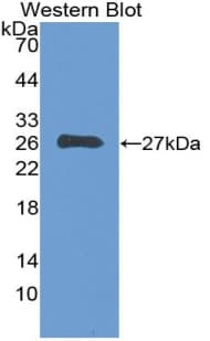Complement C1QA Antibody (aa28-245)