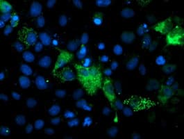 PGAM2 Antibody (clone OTI2F5)