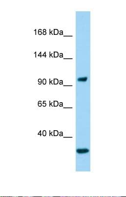 GIGYF2 Antibody (N-Terminus)