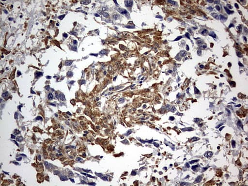 Monoclonal Mouse anti-Human RIPK3 / RIP3 Antibody (clone OTI3A3, aa233-518, IHC, WB)