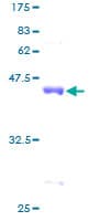 Human ARPP19 Protein (Recombinant GST)