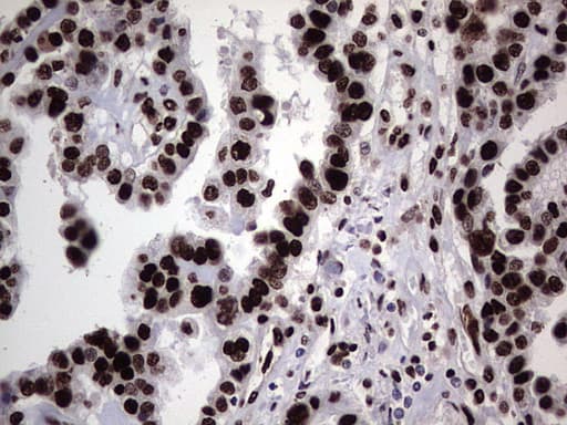 HNRNPL / hnRNP L Antibody (aa270-502, clone OTI2E4)