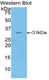LIPG / Endothelial Lipase Antibody (aa175-412)