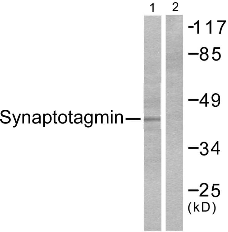 SYT1 / Synaptotagmin Antibody (p309)