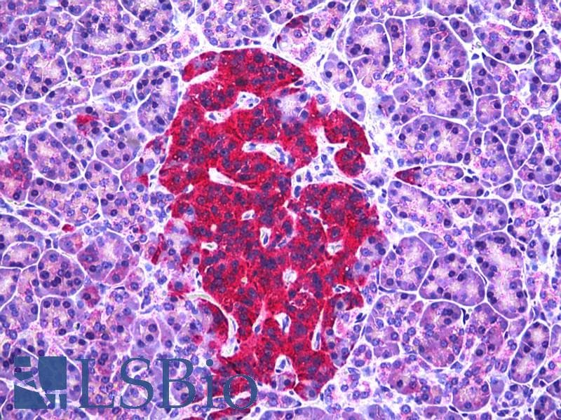 IHC-plus™ GAD / Glutamate Decarboxylase Antibody (aa545-594)
