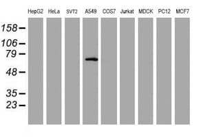 SPRING / TRIM9 Antibody (clone OTI2A9)