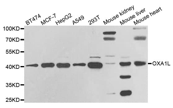 Polyclonal Rabbit anti-Human OXA1L / OXA1 Antibody (IHC, IF, WB)