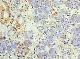 UCP1 / UCP-1 Antibody (aa1-307)