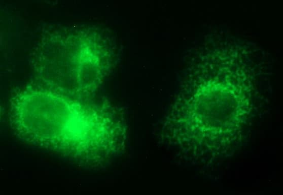 VEGFB Antibody (clone OTI1H9)