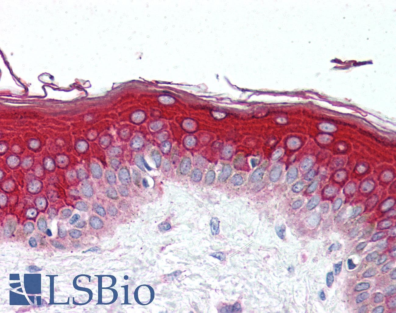 IHC-plus™ MLST8 / GBL Antibody (aa150-200)